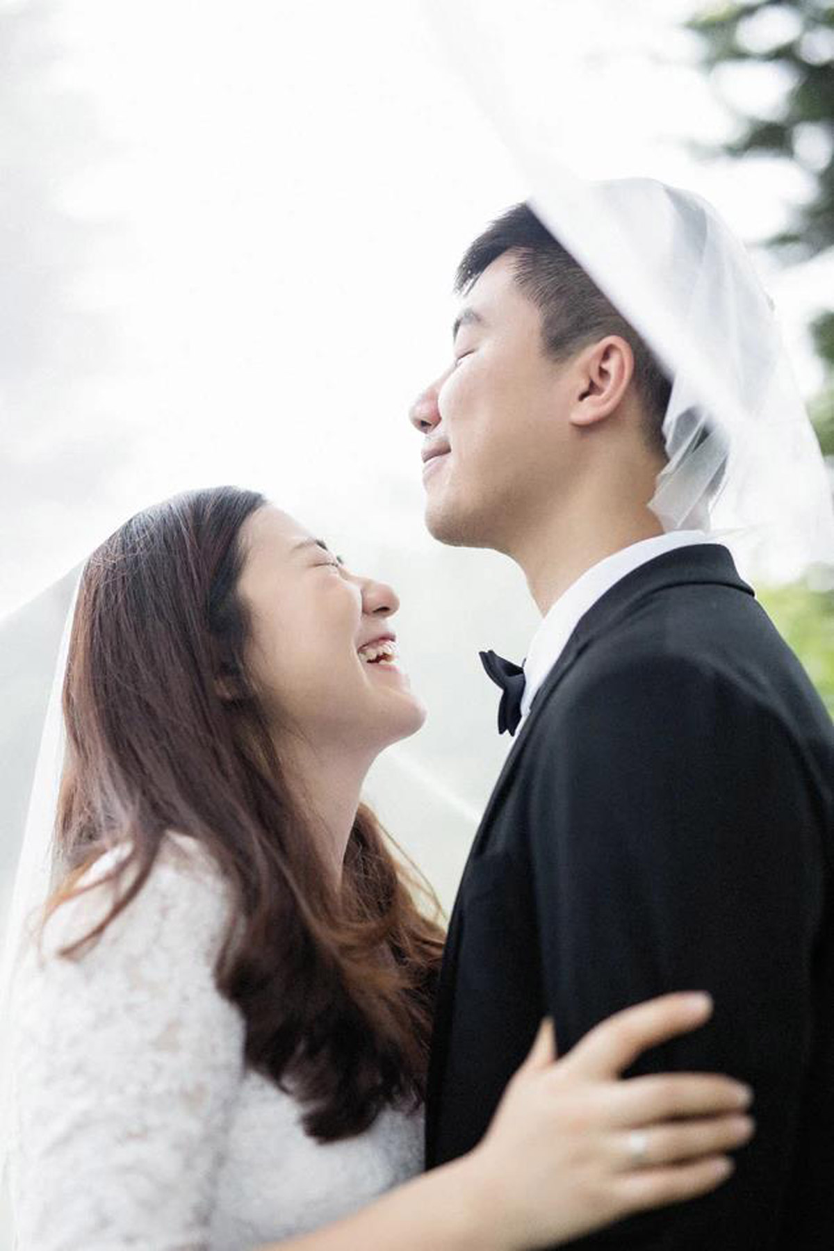 4 Simple Dental Procedures for a Better, Brighter Smile at Your Wedding