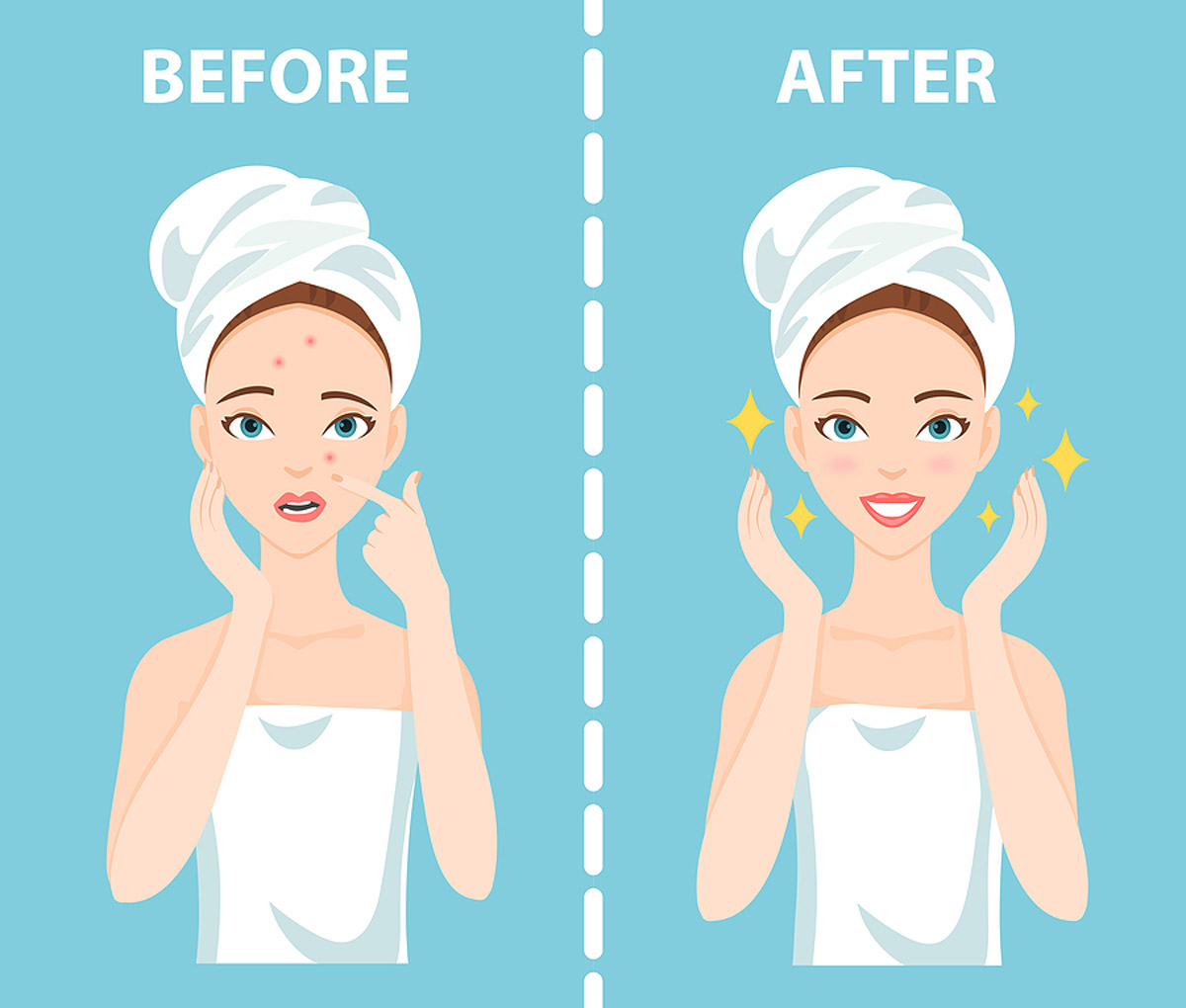 5 Tips on How to Remove Acne Scars Before Your Wedding