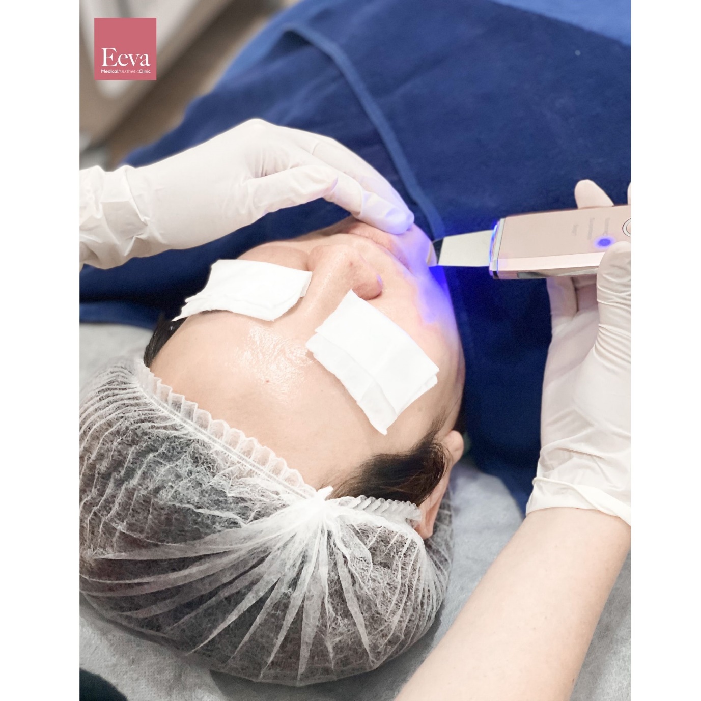 Bridal Blossom from inside out | Eeva Medical Aesthetic Clinic